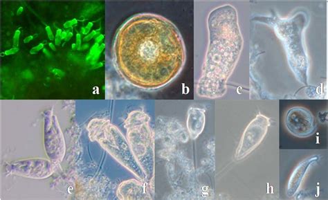  Opercularia! A Tiny Amoeboid Mastermind of Shell Construction